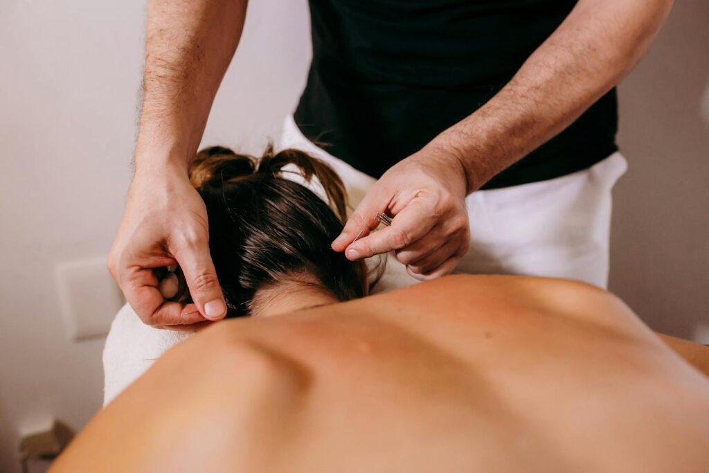 A professional performs acupuncture therapy on a woman's back for relaxation and wellbeing.